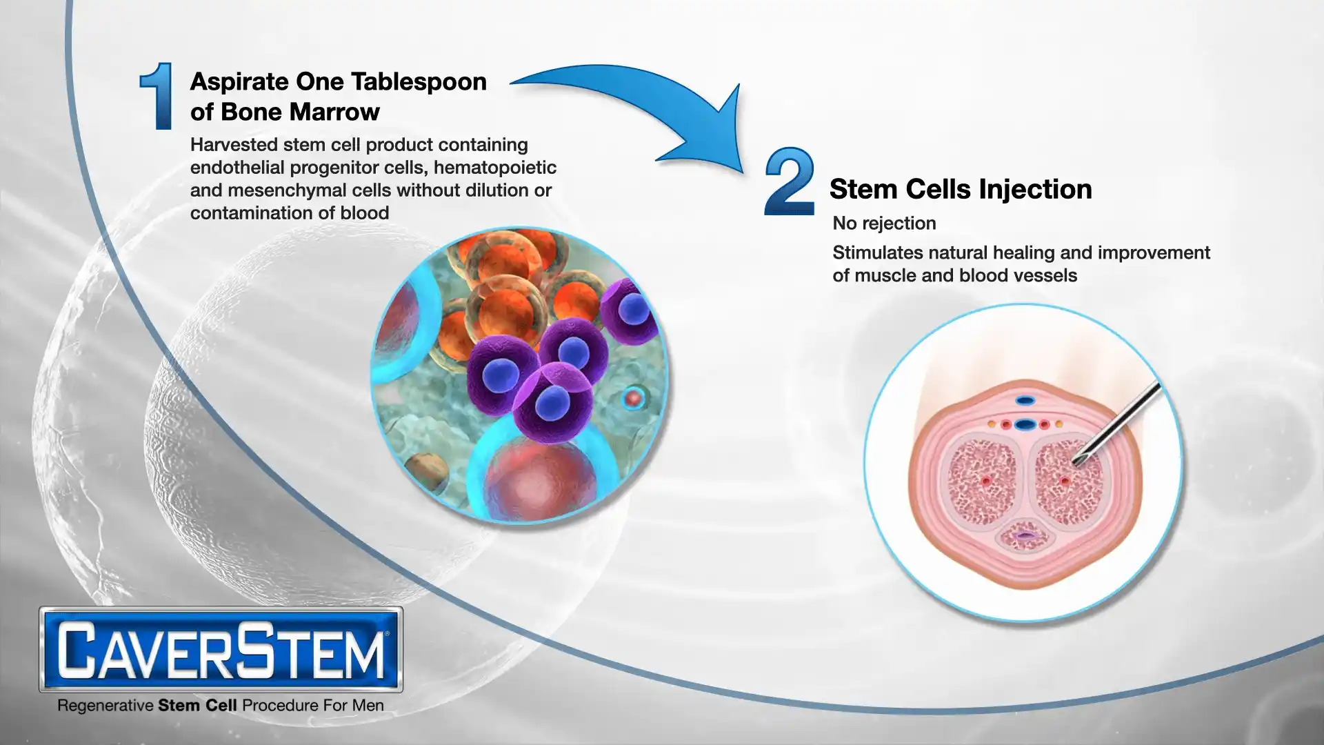 caverstem cell therapy orlando